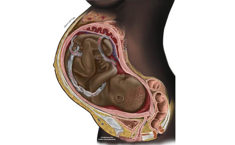 Chidiebere Ibe’s Black fetus illustration will be published Ibe reignites the conversation of the lack of skin of colour representation in medicine and innovates solutions to combat it.